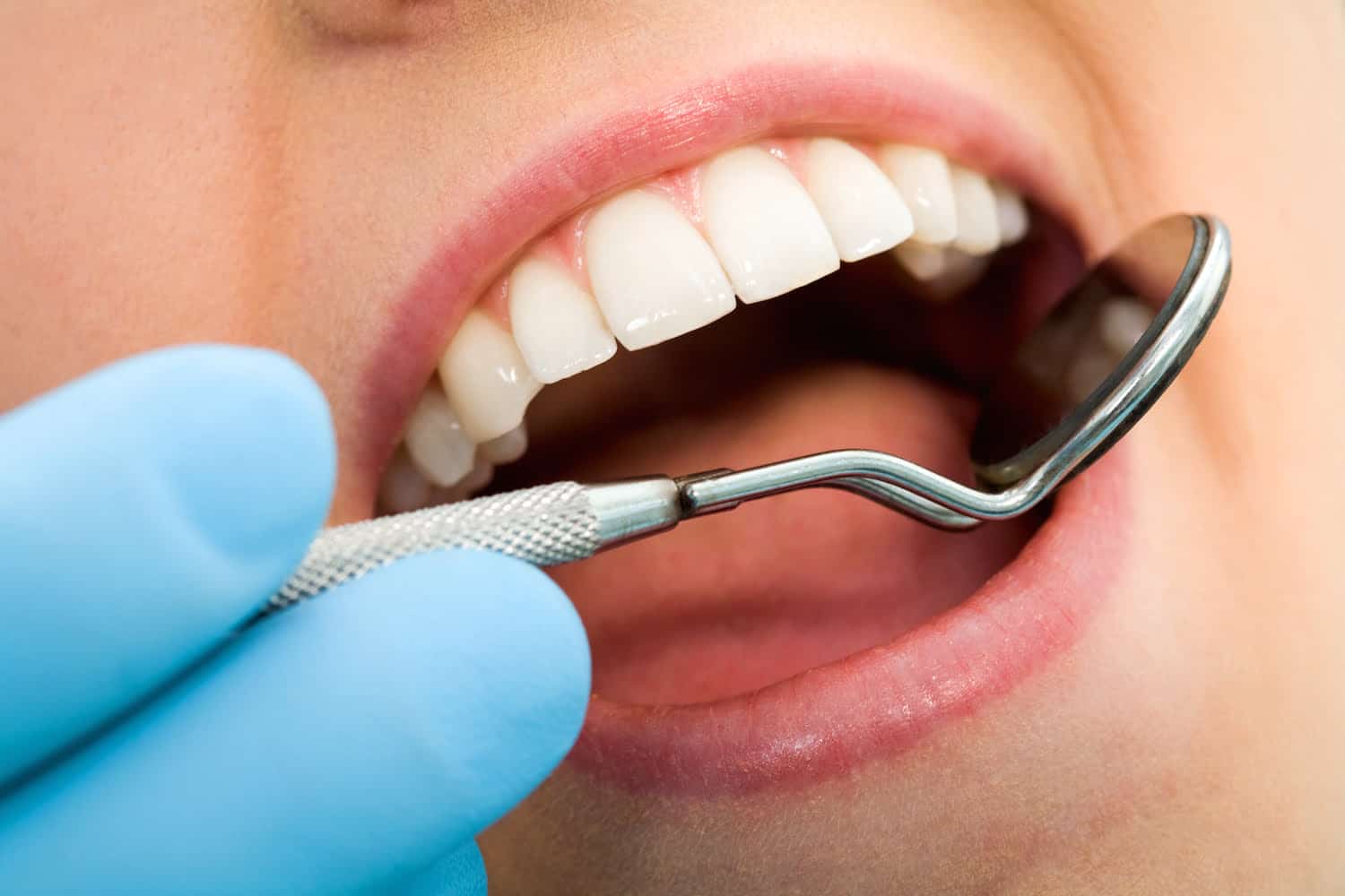 what is plaque Milford OH dentist